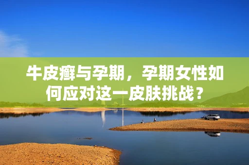 牛皮癣与孕期，孕期女性如何应对这一皮肤挑战？